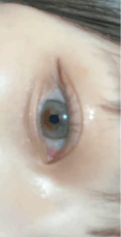 レビュー写真