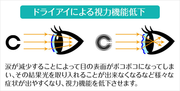 ドライアイによる視力機能低下